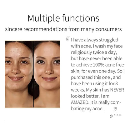 Turmeric Glow Soap – Fades Dark Spots & Evens Skin Tone